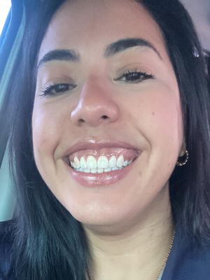 Vanessa, 33