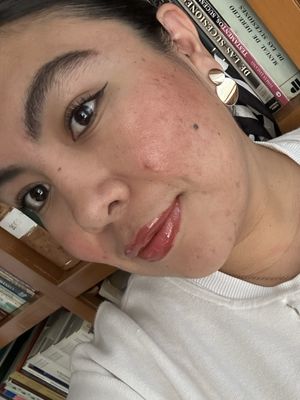 Alondra, 27