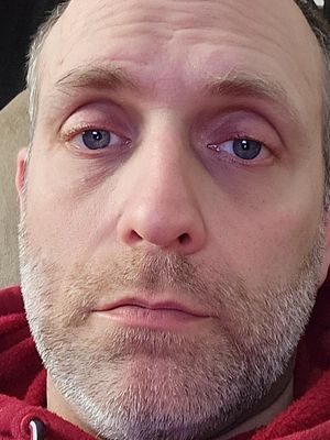 Anthony, 44