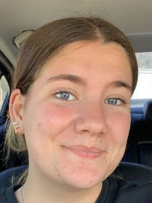 Abby, 20