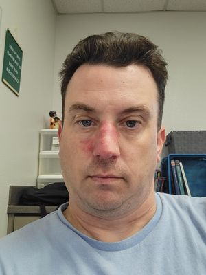 Macklin, 38