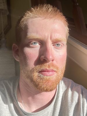 Patrick, 25
