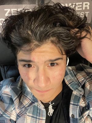 Alberto, 20