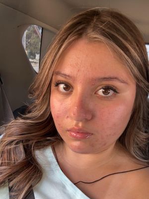 Lucy, 18