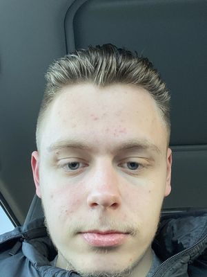 Thomas, 21