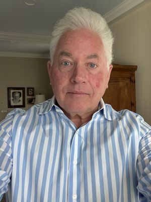 Bill, 63