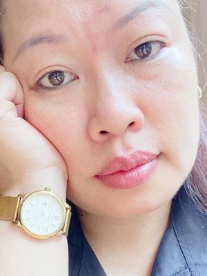 Hlinh, 44